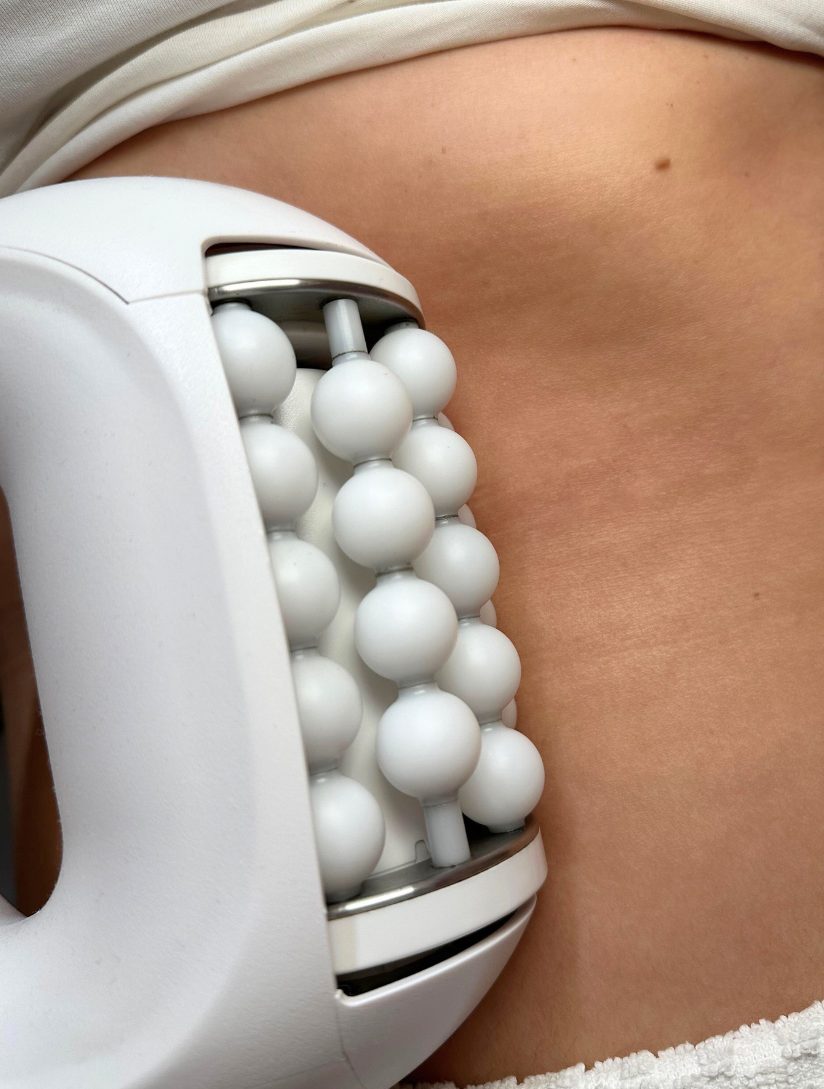 Ejemplo de tratamiento corporal con aparatología realizado por Sara Mas Maison de Beauté