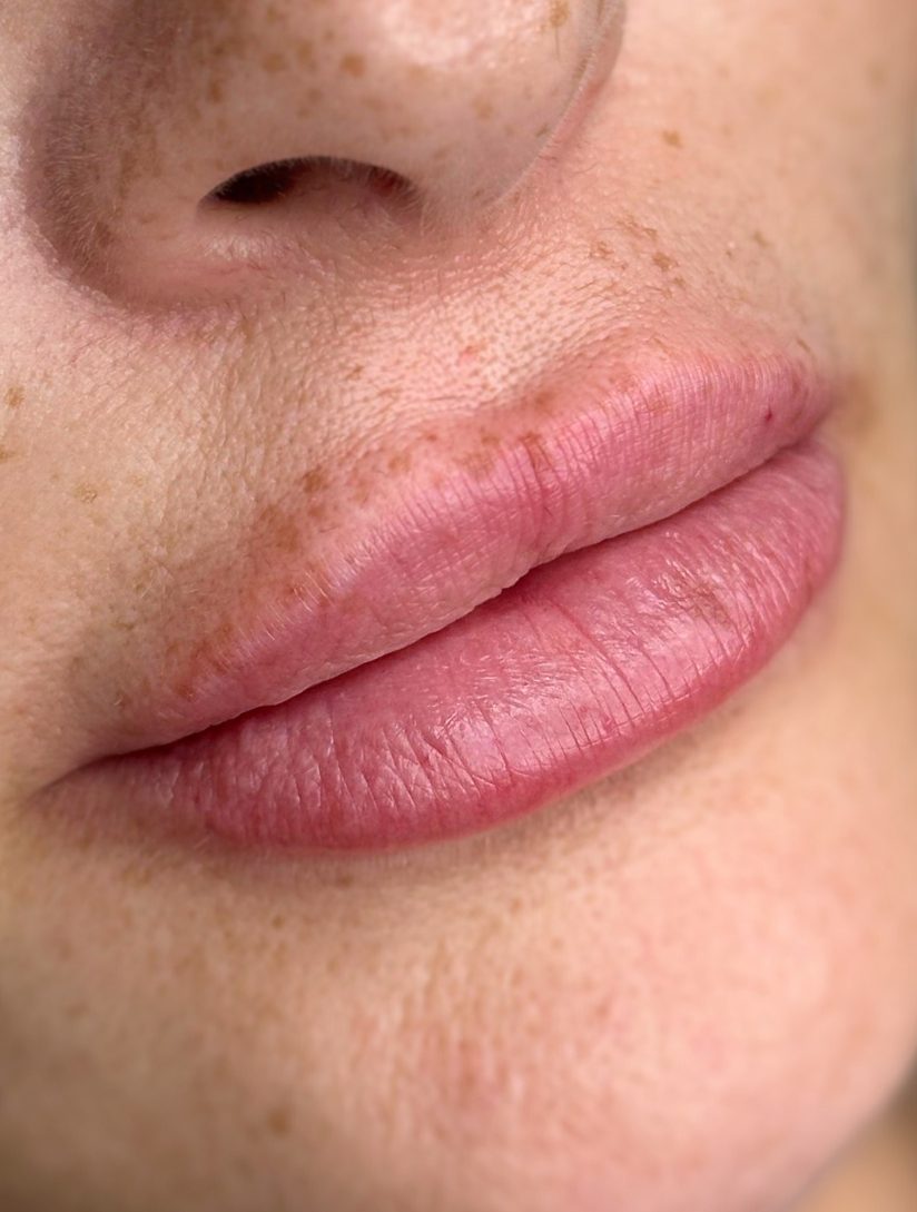 Primer plano de labios antes de una micropigmentación